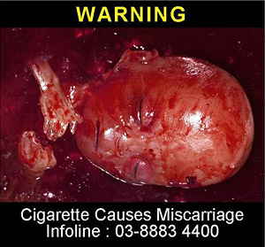 Can Smoking Cause Miscarriage